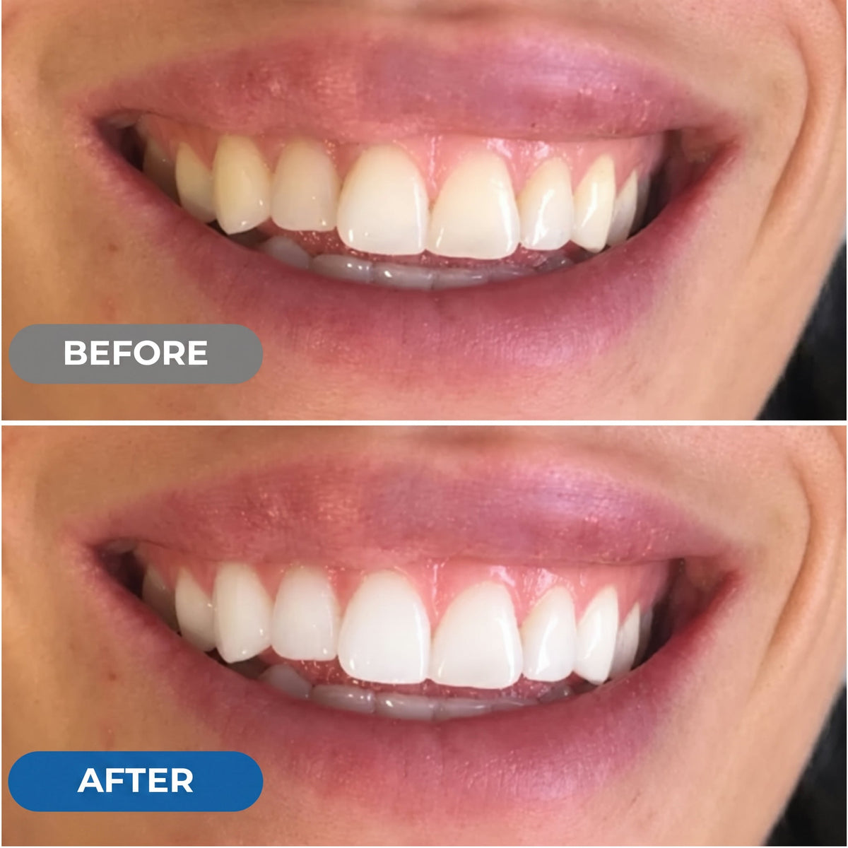 Peroxide-Free Whitening Strips 7