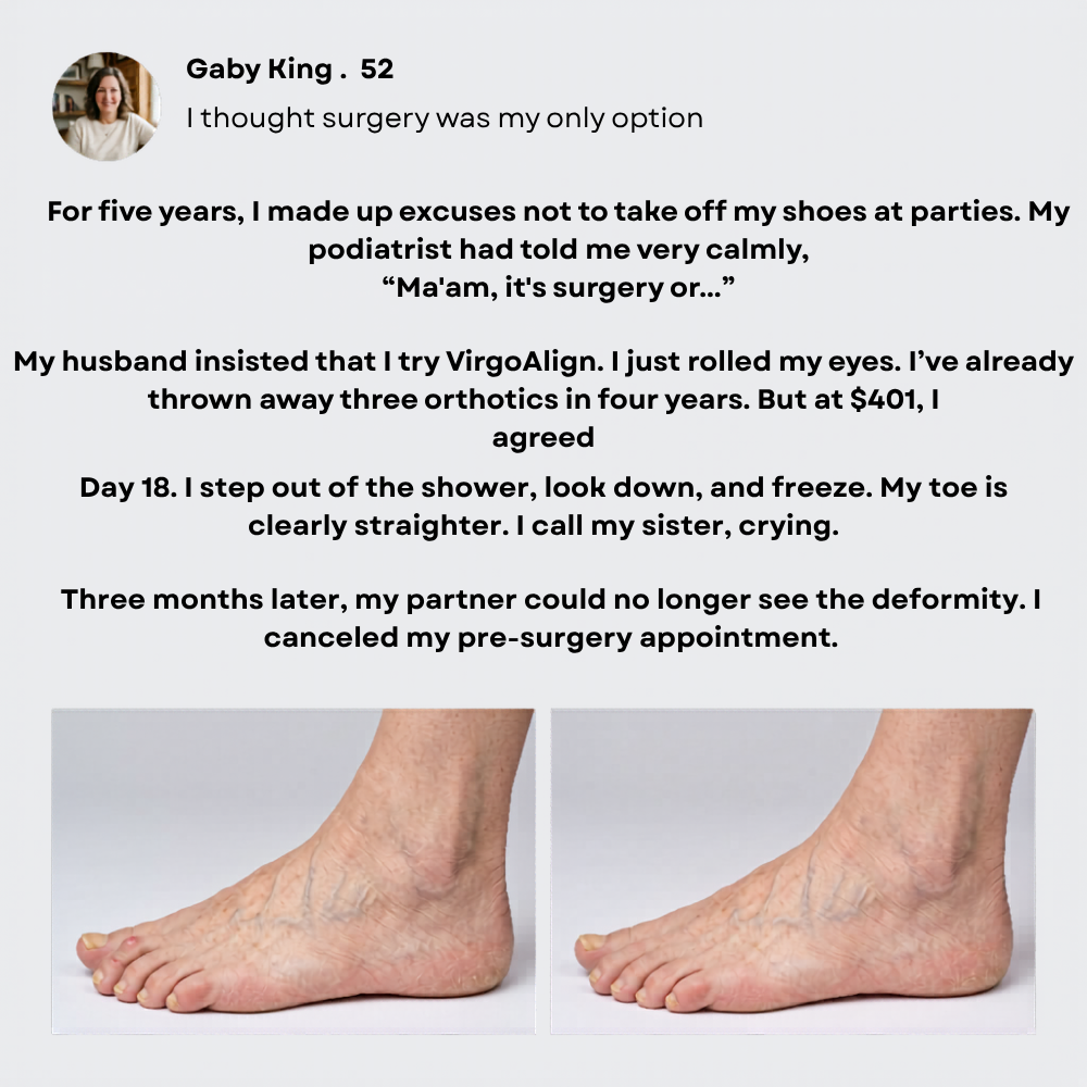 VirgoAlign Pro Toe Corrector
