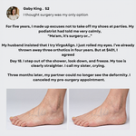 VirgoAlign Pro Toe Corrector