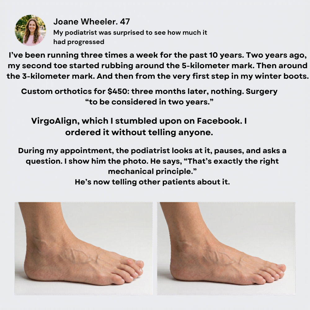 VirgoAlign Pro Toe Corrector