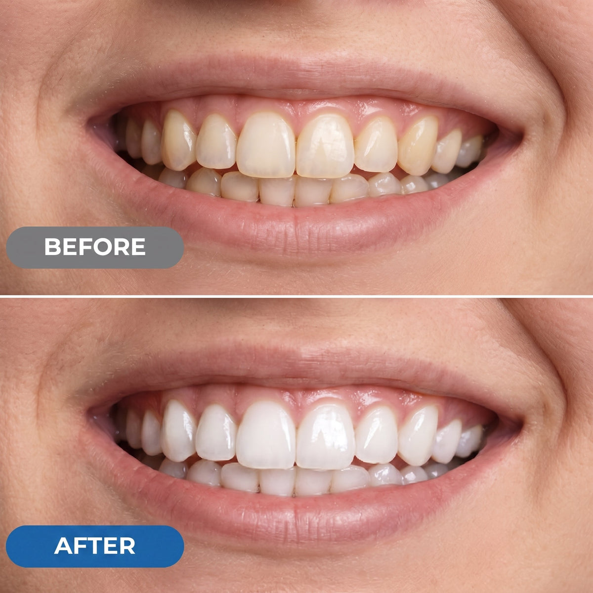 Peroxide-Free Whitening Strips 6